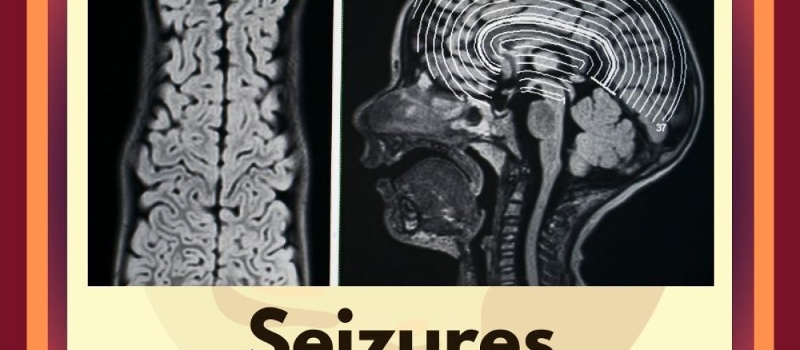 Seizures